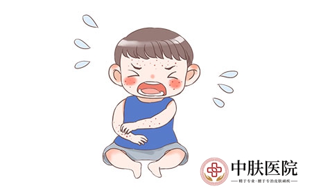 摄图网_401762381_儿童湿疹（企业商用）