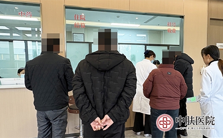 济南有治牛皮癣医院吗哪家好-济南中肤牛皮癣医院