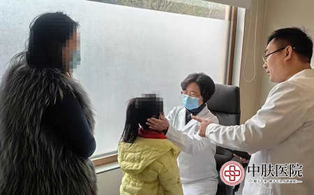 济南哪个银屑病医院专业-济南中肤银屑病防治中心