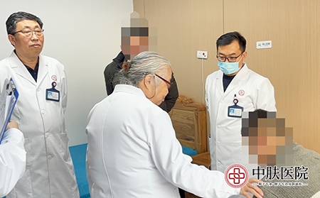 山东济南最好的银屑病医院-济南中肤银屑病医院