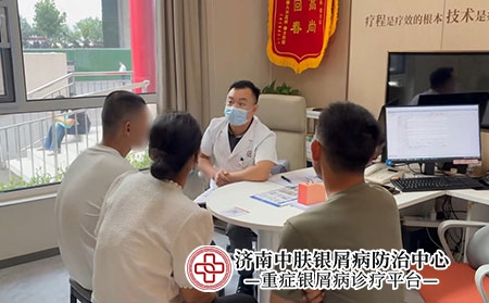 济南张代国牛皮癣主任-济南中肤银屑病医院 济南张代国牛皮癣主任-济南中肤银屑病医院