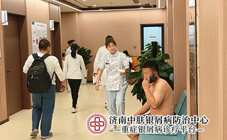 济南银屑病康复指导 - 济南中肤医院