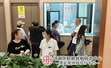 济南银屑病专科医院-济南中肤医院