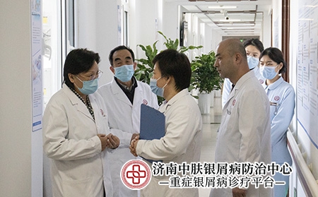济南银屑病抗复发治疗-济南中肤医院
