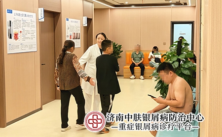济南银屑病中西医结合-济南中肤医院