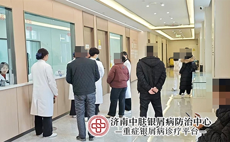 济南银屑病医保-济南中肤银屑病医院 济南银屑病医保-济南中肤银屑病医院